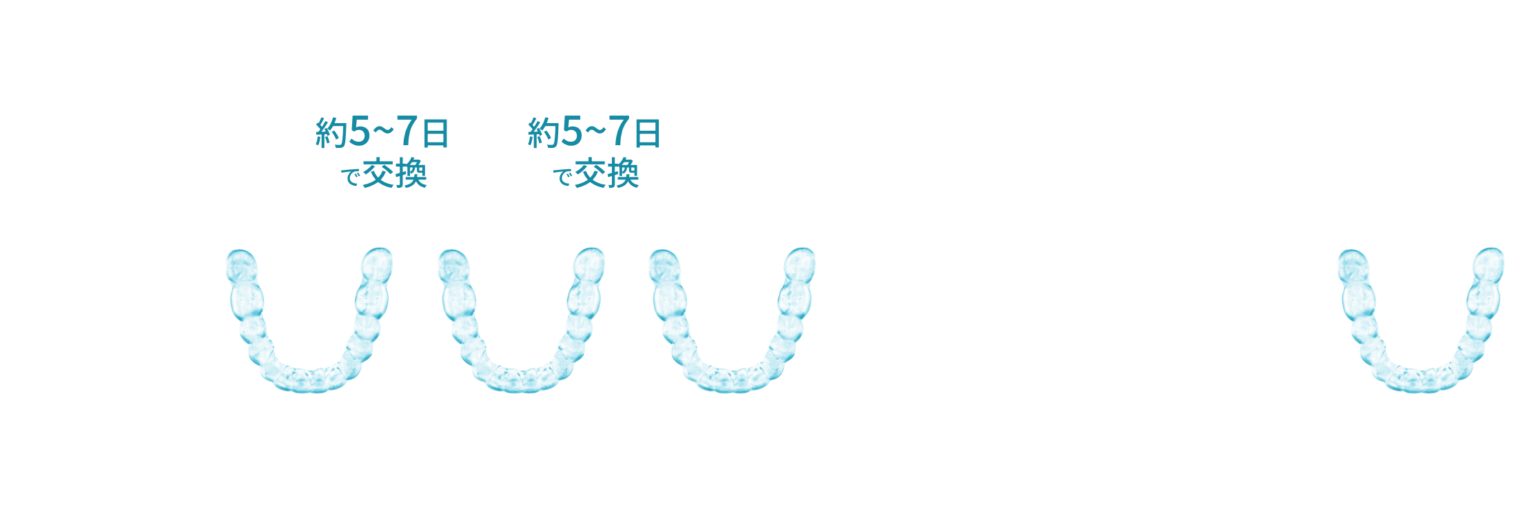 現在の歯並びに近い形のマウスピース（インビザライン）から徐々に理想的な歯並びと同じ形のマウスピース（インビザライン）へ約5〜7日のスパンで交換していく