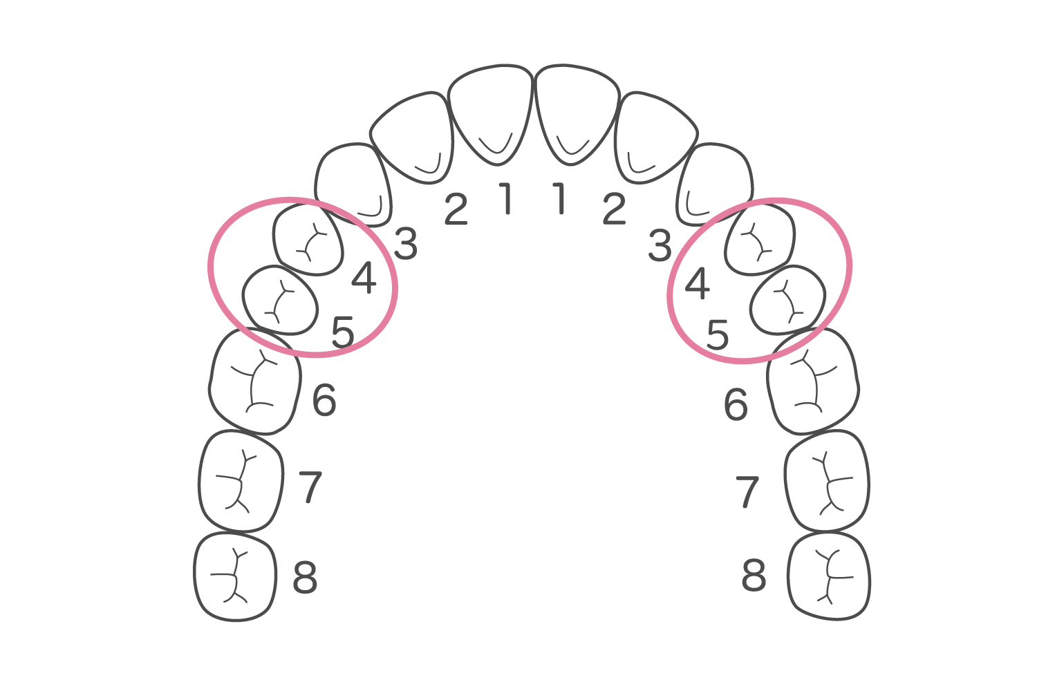 歯型を上から見たイラスト。前歯から数えて左右ともに4,5番目にピンクの線で丸がついている